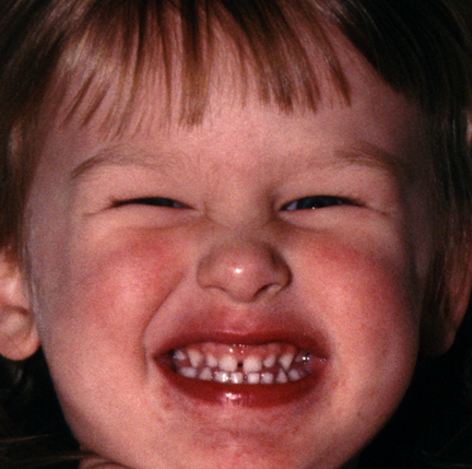 Evil Grin